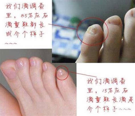 漢人的腳指甲